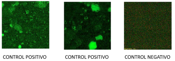 control de las placas po microscopia de fluorescencia